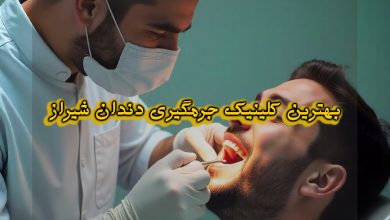 بهترین دکتر جرمگیری دندان در شیراز