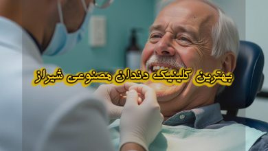 بهترین متخصص دندان مصنوعی شیراز