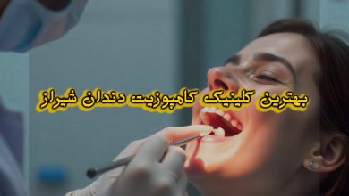 بهترین دکتر کامپوزیت دندان شیراز