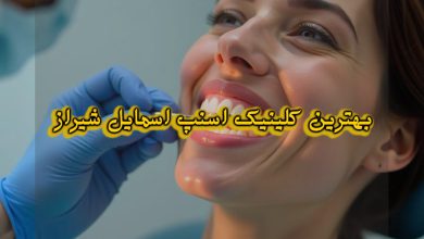 بهترین کلینیک اسنپ اسمایل در شیراز