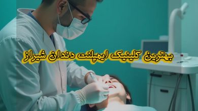 بهترین متخصص ایمپلنت دندان در شیراز